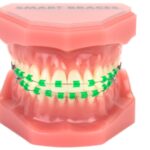 Smart-Braces-Green